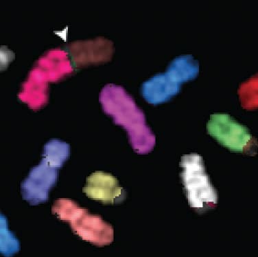 BRCA1 mutant cell chromosomes Jackson