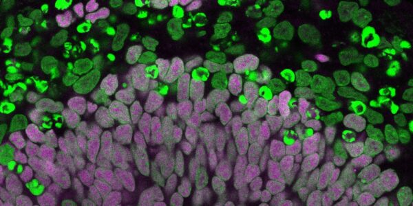 Fluorescence microscopy of section through a human cerebral organoid, from the Brand lab.