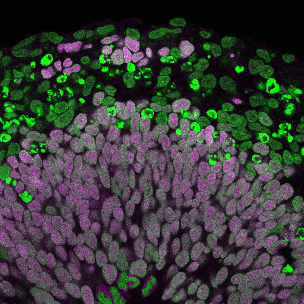 Fluorescence microscopy of section through a human cerebral organoid, from the Brand lab.