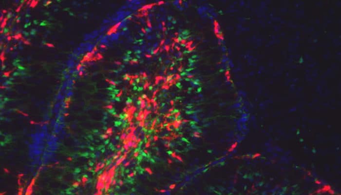 Regenerating cerebellar cells identified by lineage tracing