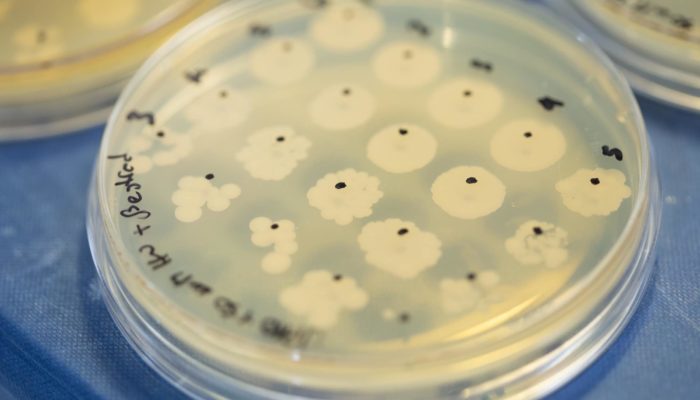 Yeast colonies growing on a screening plate