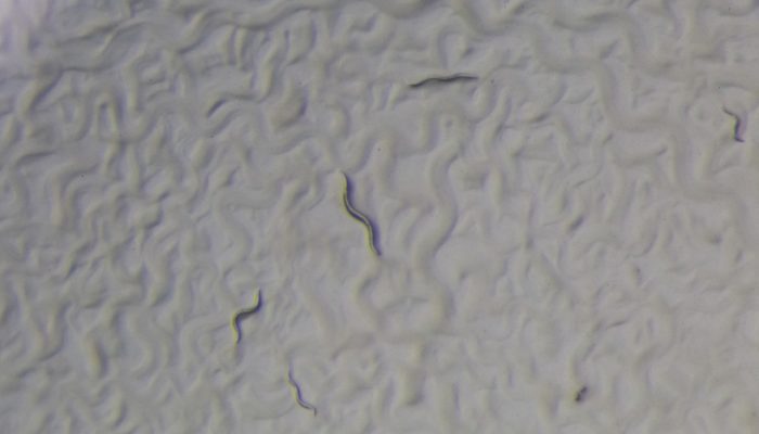 Nematode worms through the microscope