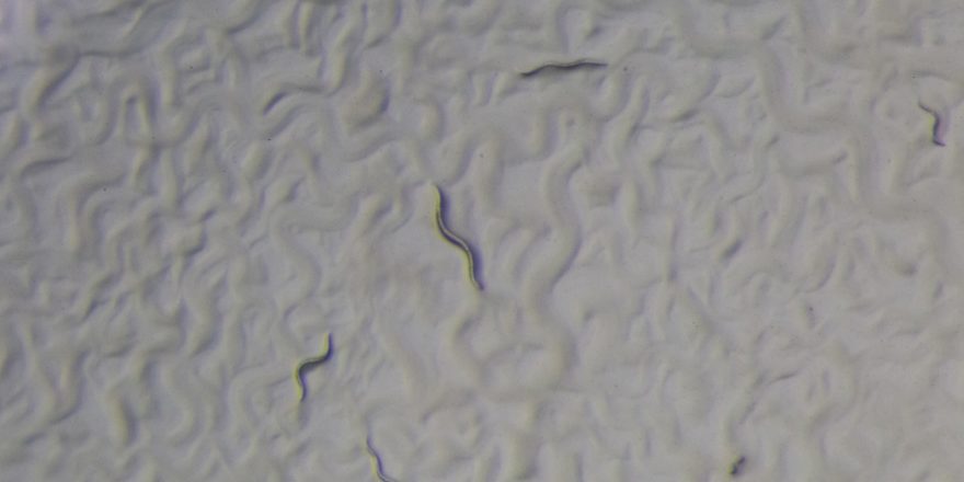 Nematode worms through the microscope