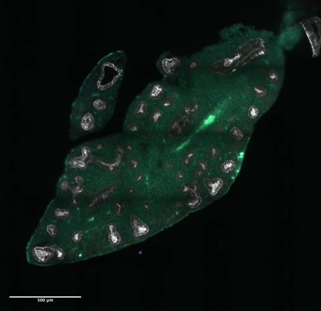Sample of cleared lung tissue imaged by lightsheet microscope