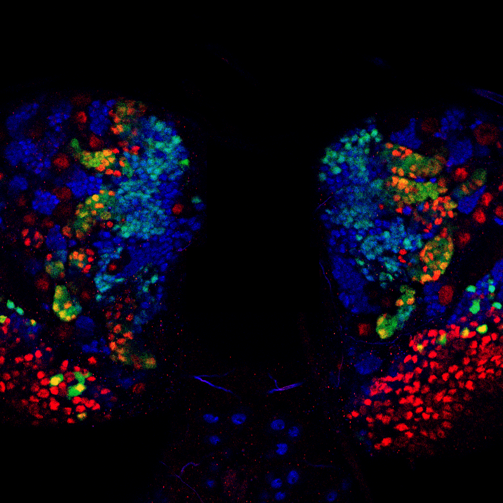Fruit fly brain imaged with NanoDam technique fluorescent markers