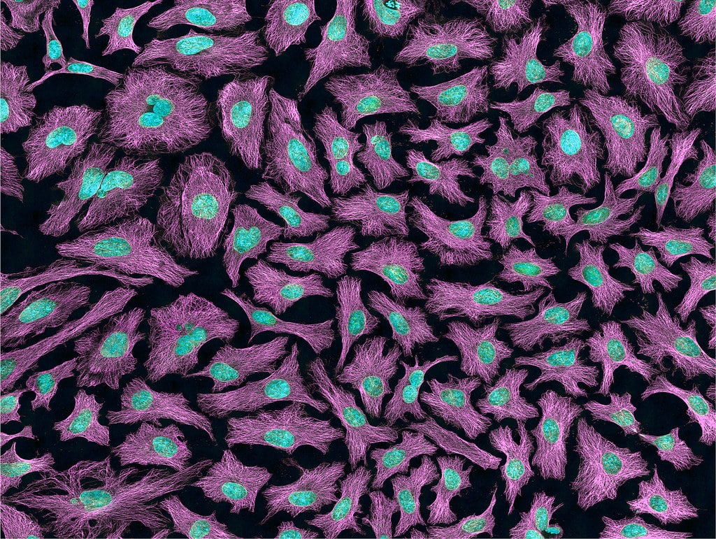 Microscopy image of HeLa cells stained pink with blue nuclei