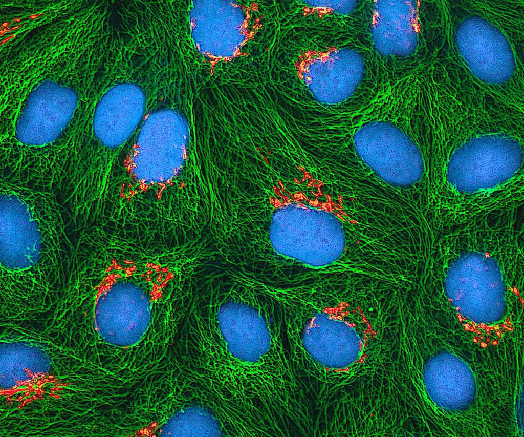 Green HeLa cells with nuclei stained blue