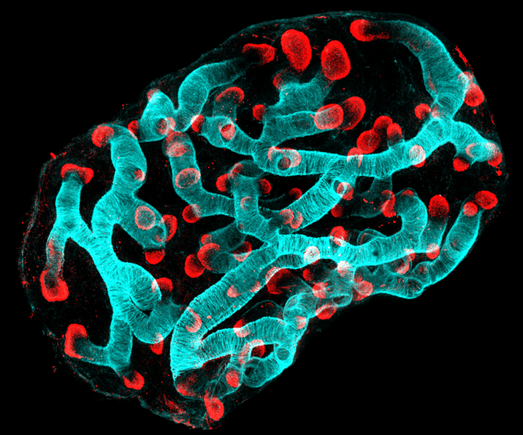 Microscopy image of human fetal lung explant shows birfurcating tips (red) and airway smooth muscle actin (cyan); by John Russell (Rawlins lab)
