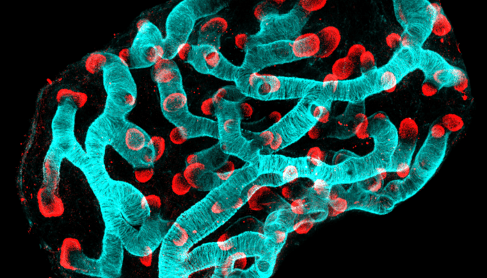 Microscopy image of human fetal lung explant shows birfurcating tips (red) and airway smooth muscle actin (cyan); by John Russell (Rawlins lab)