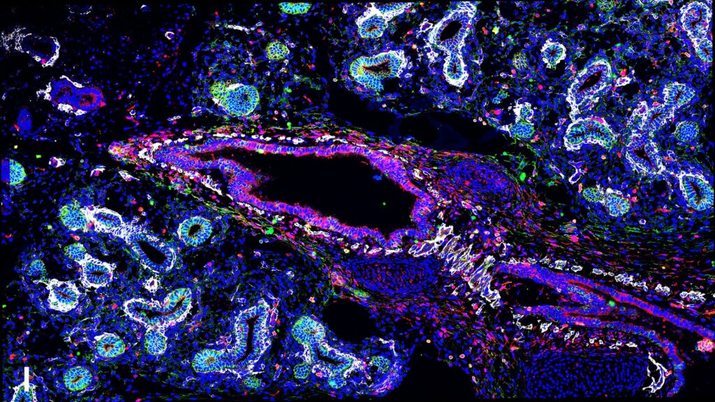 Rawlins group_Human fetal lung tissue staining image describing a signalling niche for airway development