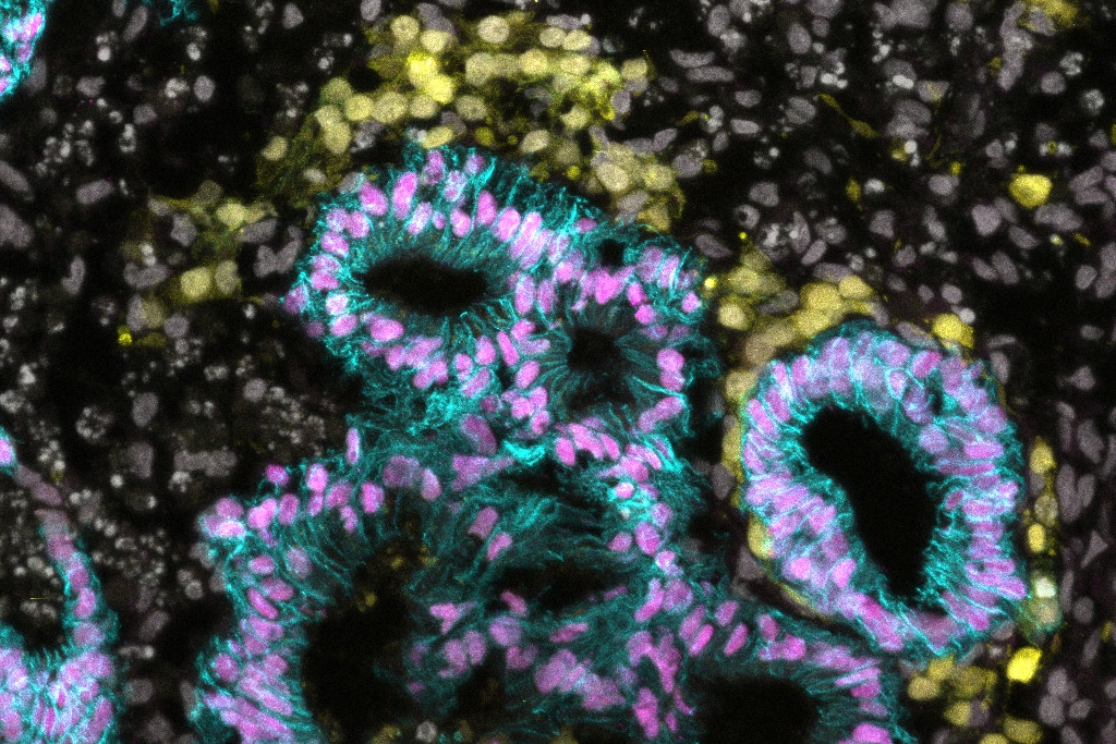 Human primordial germ cell-like cells (yellow) co-cultured with human hindgut organoids (magenta/cyan).