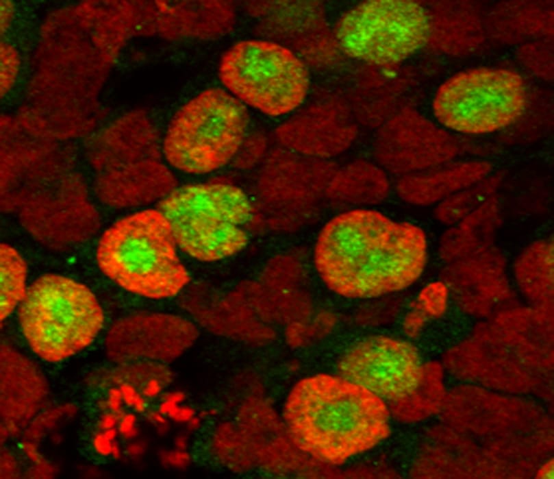 Immunostaining of a human female genital ridge in the 8th week of embryonic development depicting levels of H3K4me1 (red) and POU5F1 (green) in gonadal somatic cells and primordial germ cells (PGCs). Note that POU5F1-positive PGCs exhibit higher H3K4me1 levels than the surrounding somatic cells.