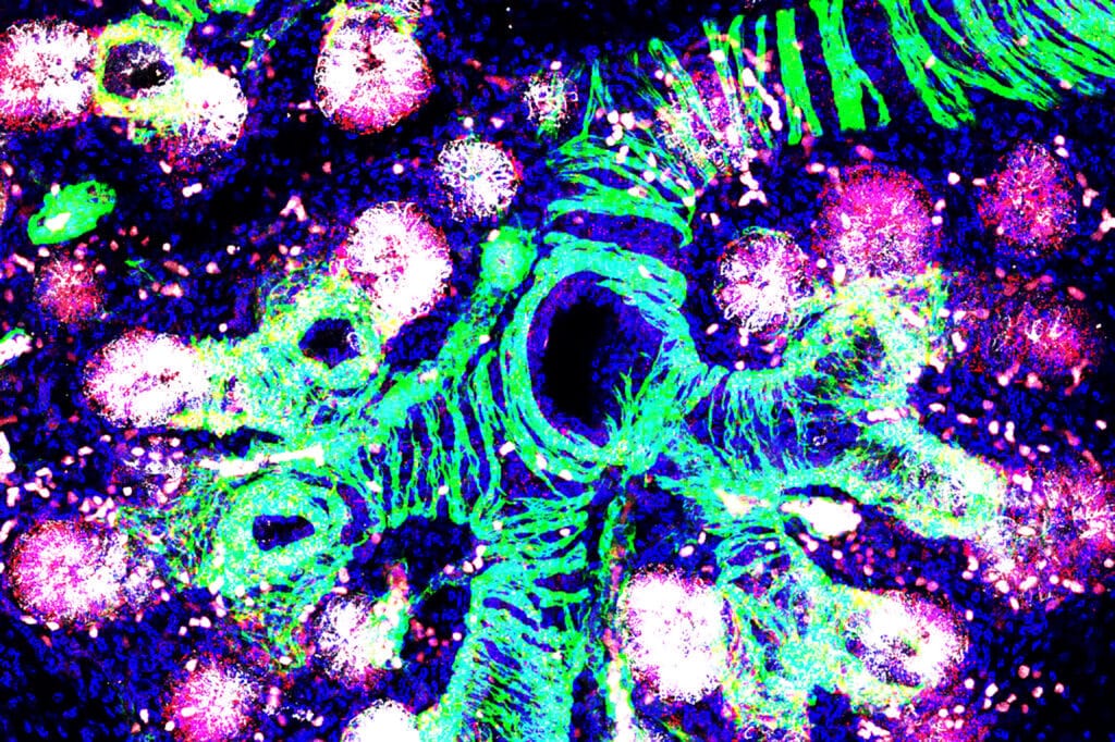 16 weeks post-conception human fetal lung. The branching airway tree is surrounded by bands of developing smooth muscle (green), which also labels the developing vasculature. The epithelial progenitor cells (co expressing SFTPC in white and NOTUM in red) are initiating the process of alveolar epithelial development. Image supplied by co-author Emma Rawlins (University of Cambridge), image credit Dr Kyungtae Lim.